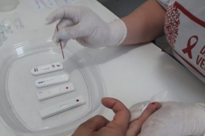 Paranaguá oferece teste rápido para diagnóstico de sífilis