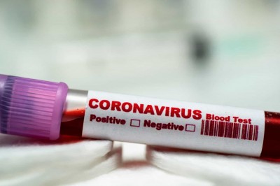 Brasil tem 1º resultado positivo para coronavírus