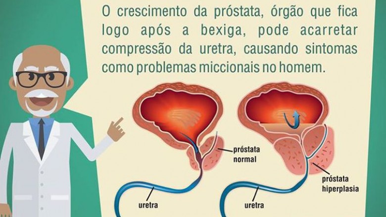 Um em cada seis homens tem câncer de próstata no Brasil, alerta Inca