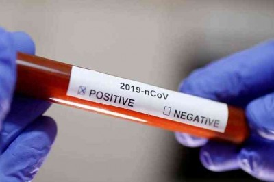 Ministério da Saúde confirma seis casos do novo coronavírus no Paraná