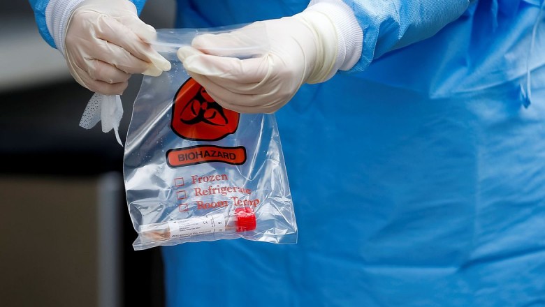 500 mil kits de teste rápido do COVID-19 chegam ao Brasil