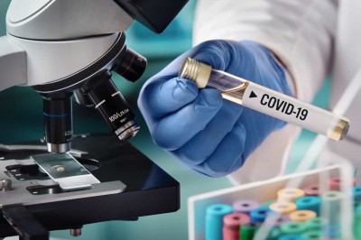 Anvisa libera farmácias para aplicarem teste rápido de covid-19